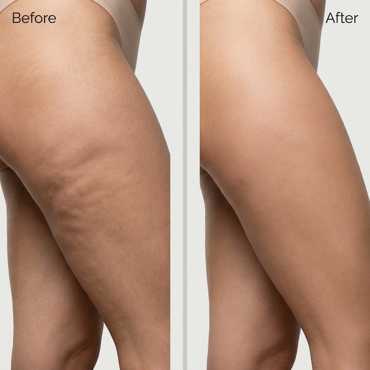 Lidra™ Anti-Cellulite Massage Oil